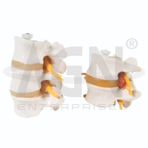 2 Lumbar Vertebrae 3 Lumbar Vertebrae