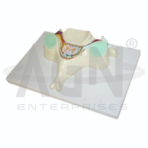 5TH Cervical Vertebra