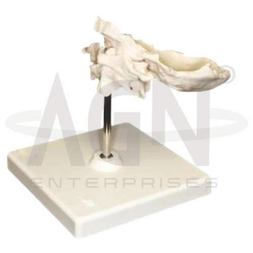 Axis And Occipital Bone (atlas)