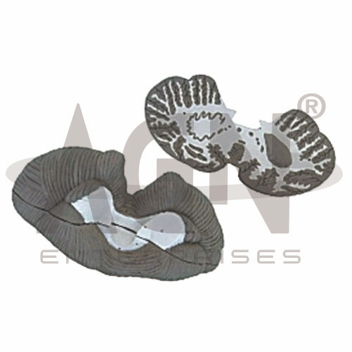Cerebellum 2 Parts