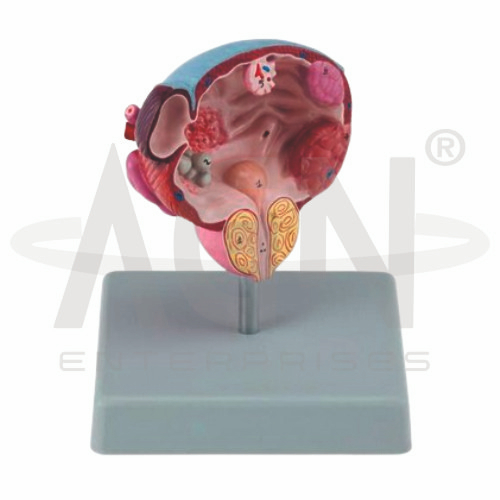 Diseases Of The Urinary Bladder & Prostate