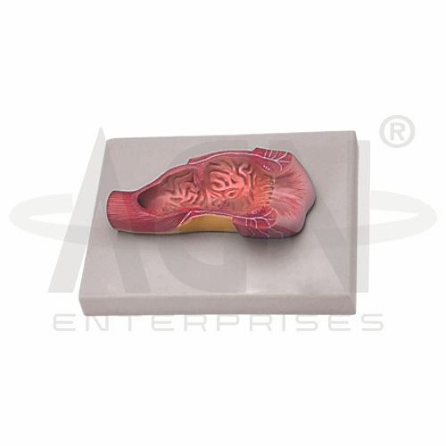 Human Anus Model