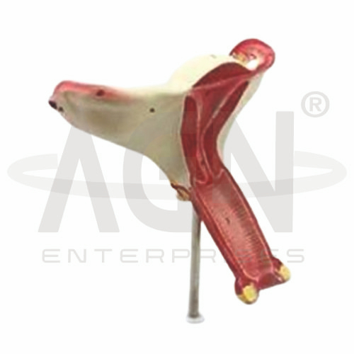 Internal Female Reproductive Organs