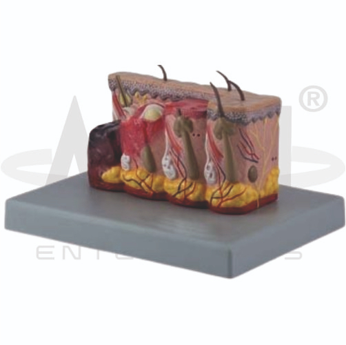 Pathological Model Of Burned Skin