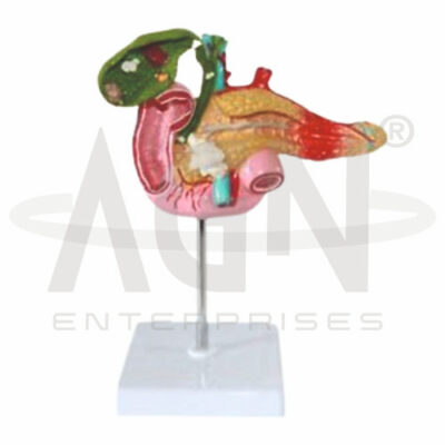Pathological Model Of The Pancreas