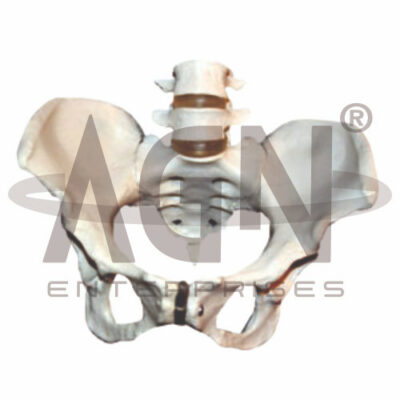 Pelvis With 4th And 5th Lumbar Vertebrae