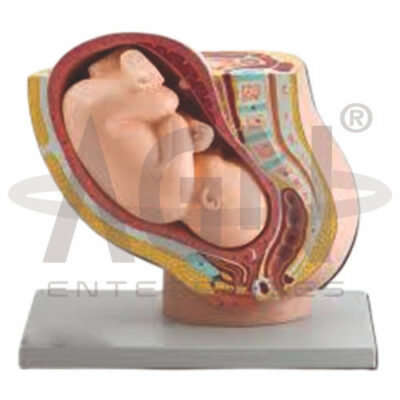Pregnancy Pelvis With Mature Fetus