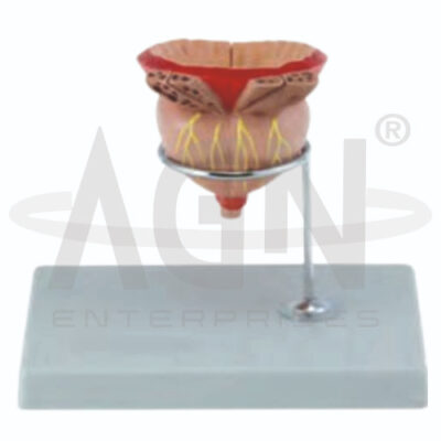 Prostate Model