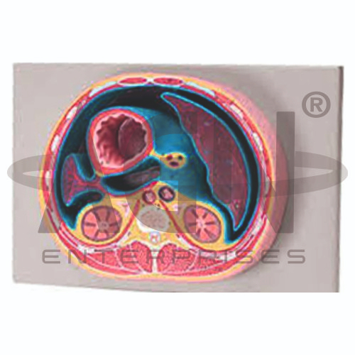 Schematic Cross Section Through Thorax (T12)