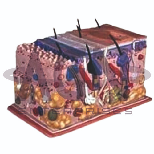 Skin Block Model